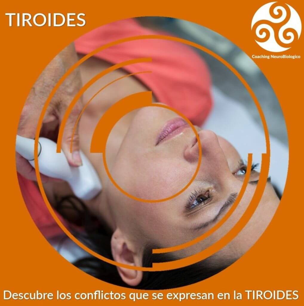 Tiroides