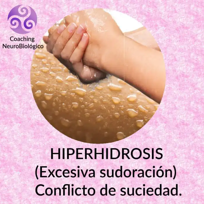 hiperhidrosis excesiva sudoracion