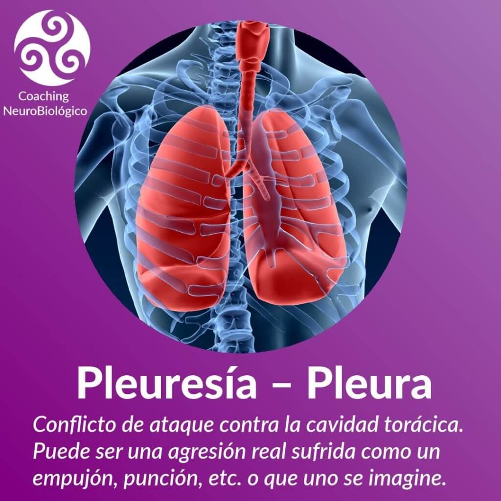 pleura pleuresía