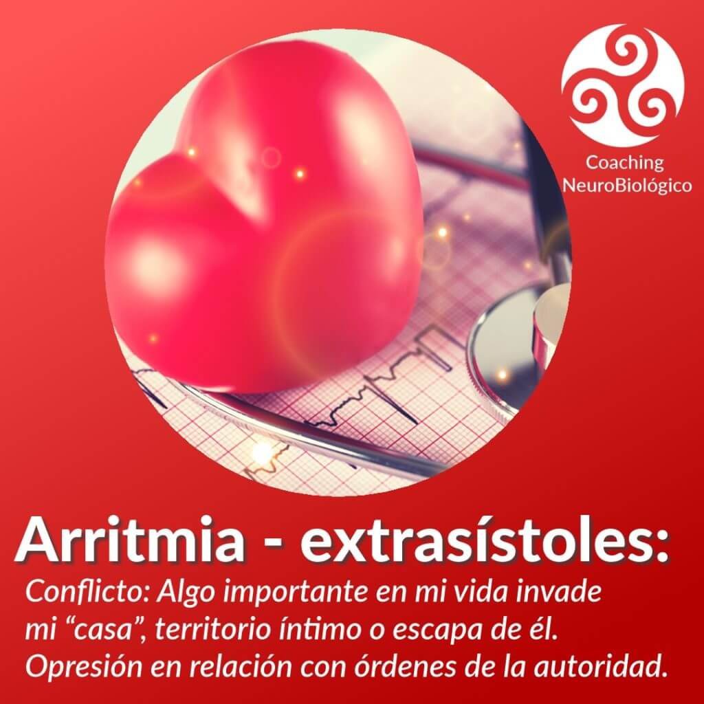 Arritmia Extrasístoles