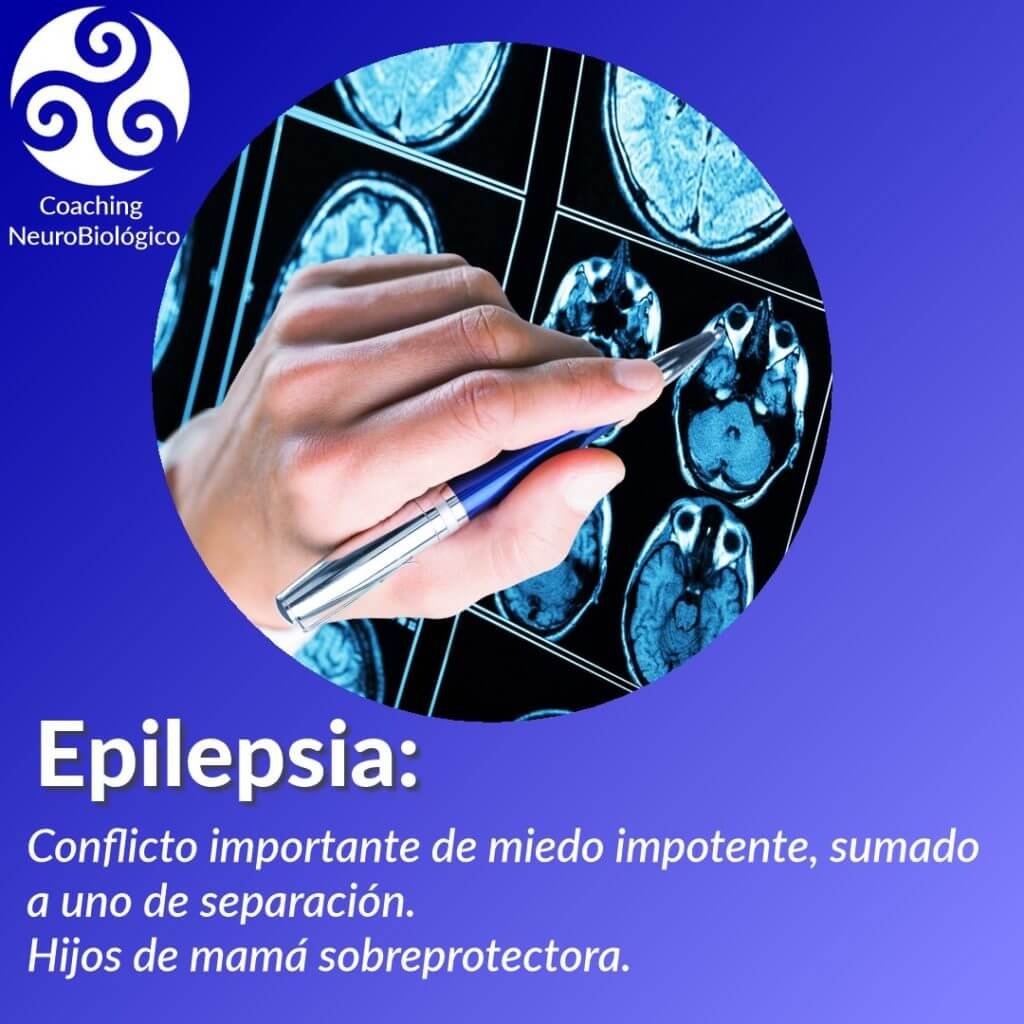 Epilepsia