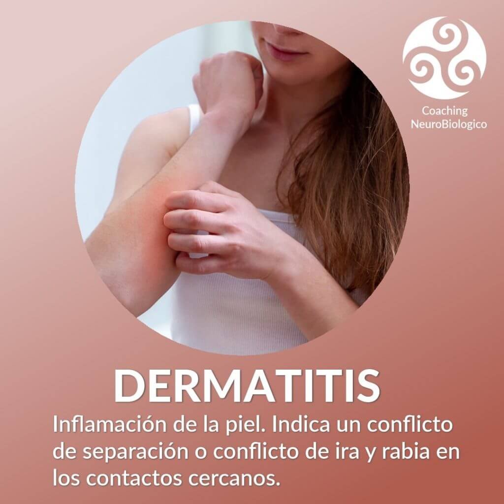 Dermatitis