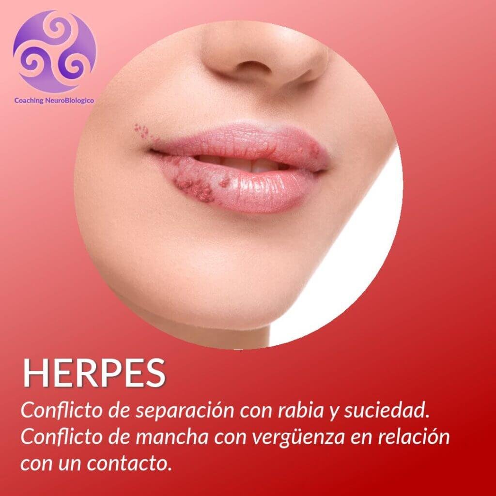 Herpes