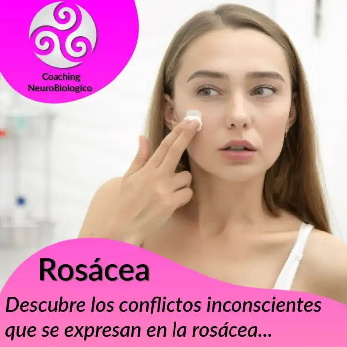 rosacea piel