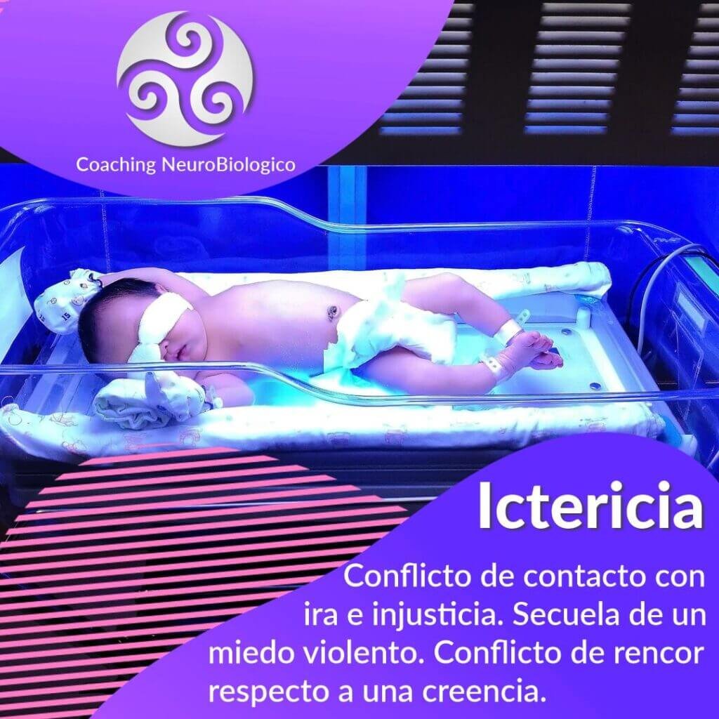 Ictericia