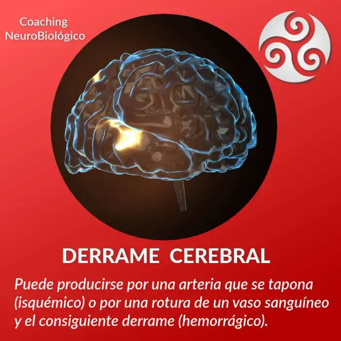 prevenir acv derrame cerebral